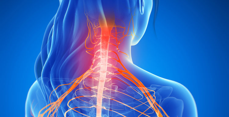 Neuralgia Cervicobraquial S Ntomas Y Tratamiento Con Osteopat A