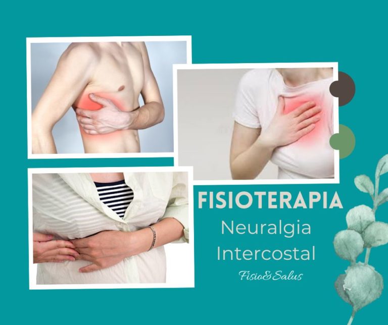 neuralgia-intercostal-fisio-salus