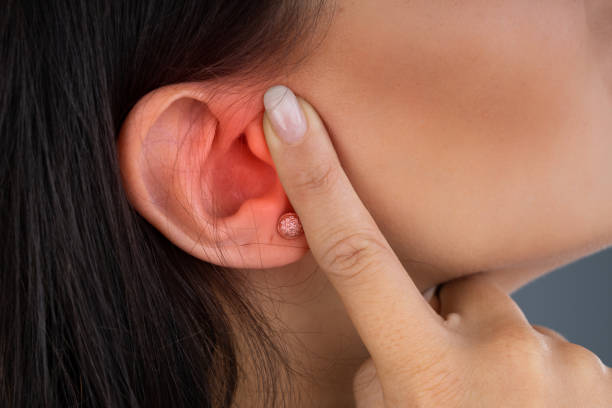 Fisioterapia y Tinnitus